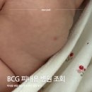 수영어린이병원 | BCG 피내용 접종 어디서 병원 조회 찾는 법 부산 후기