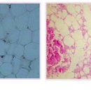 나사랑의원 이미지