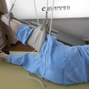 무릎 내측 반월판 수술후 2주후 실밥뽑고 래원한 환자입니다. 이미지