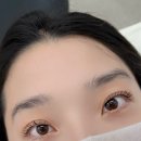 아이플로아