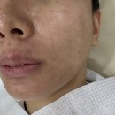 유포리아 에스테틱 | 청량리피부관리 유포리아 에스테틱 잡티톤업케어 후기