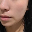 센텀 피부관리 헤스티움 재생관리 솔직후기