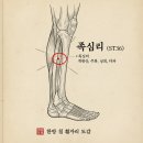 족삼리 (足三里)-혈자리를 활용 한방침 처방과 활용 이미지