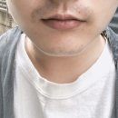 송준호레이메디의원 네이버블로그