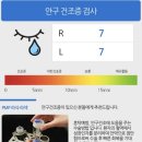 (주)디비후레쉬 | 강남 밝은성모안과의원 라섹 9일차 후기