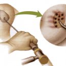 엠에스피지컬 이미지