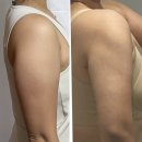 팔센치 | 팔 무한람스 3개월차 유지 가능 솔직후기 몇센치 줄었을까?