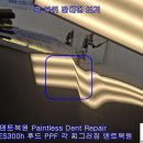 크라운덴트 이미지