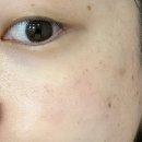 케이스타의원 네이버블로그