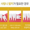 서울턱사랑니치과 이미지