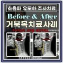 천안튼튼정형외과 이미지