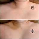 파리바게뜨 대전유성장대동지점 | 대전 유성 장대동 얼굴관리는 리세스뷰티샵 윤곽관리 후기 얼굴 라인 정리 효과