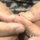 '발암추정물질' 당뇨약 복용 26만명 어쩌나…"임의 중단 말아야" 이미지