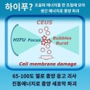 조양기전