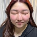 메디포올 | 매끈하고 탄력있는 피부 관리 압구정역 스킨플래닝은 메디포올