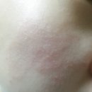 진솔미코리아 | 진솔미코리아 천연비누, 아토피비누 사용후기 입니다. (아토피가 있는 딸이 직접 사용해 봤습니다. )