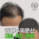 흥미 헤어라인 | 김해두피문신 헤어라인 고민, 에테르노에서 상담받은 후기