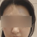 이룸스킨공간 - 춘천시 | 이수피부관리 Nuskin 피부관리, 두피관리 이룸스킨공간 이수점 솔직후기