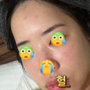 리라피부과의원 | 지연성 알러지 검사 및 실비 환급 후기