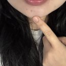 영화한의원 | 강남역 한의원 기미 잡티제거 피코레이저 내돈내산 대만족 - 1주차 솔직후기