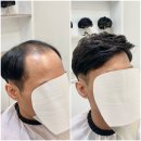 마스터가발 김호증모 영등포