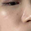 더마코스메틱샵 | 인포디플러스 더마코스메틱 젤리클렌저 후기 약산성 모공 블랙헤드 케어 루틴