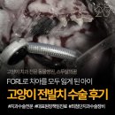 이:은동물병원 | 고양이 전발치 후기, 심각한 질환으로 치아를 모두 잃은 아이(ft. 치과 전문 동물병원)