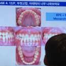 딜리버리로우 | [임상세미나] 성장기 환자에서 프리올소의 임상적 활용, preortho 세미나 참석 리뷰&amp;후기 2편