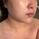 금손명가분점 | [전남 나주] 나주빛가람동에스테틱 원탑 나주피부관리 나주웨딩관리 전문 디바스킨 본점 깐달걀 피부...
