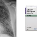 (주)인터큐어 | 라이선스 아웃에 특화된 NRDO기업, 브릿지바비오테라퓨틱스