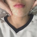 완산-38 | 전주 효자동 왁싱 몽땅스킨몽땅왁싱 세라링플래닝 후기