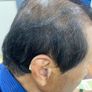 독일보청기 | 성남독일보청기 시아버님 보청기 맞춤 후기