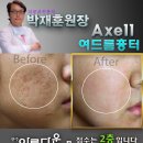 전주아름다운피부과 티스토리