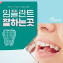 임플란트 치료 후기, 유성치과 덴티치과의원