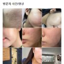 린앤스킨 네이버블로그