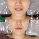 밤비에스테틱
