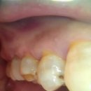 시원플란트치과의원 이미지