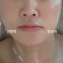 피부엔 이슬 | 군산 피부관리 웨딩케어 피부엔이슬 온다리프팅 탄력관리 후기