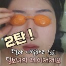 안산제로의원 | 2탄 ) 털보녀의 안산 레이저 제모 10+5 회 내돈내산 후기 [제로의원]