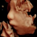 더벤티범계점 | 봄빛병원 입체초음파 4D 후기, 초음파 보고 남편과 데이트, 나혼자 쇼핑!