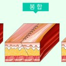 더노블강남삼성성형외과 이미지