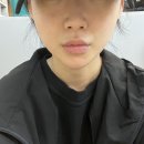 예신다이어트청담 | 웨딩 본식전 필수 예신관리 청담피부과 티타늄리프팅 솔직후기
