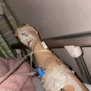 조산 | <응급제왕> 35주1일 조산 후기, 임신성지방간 급성신부전/ 이대목동 출산