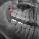 호평나무치과의원 이미지