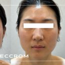 매끄롬 부산 명지점