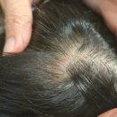 잠실비엘에스의원 이미지