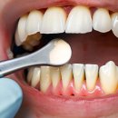 거여서울치과의원 이미지