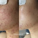 온에스테틱 아카데미 이미지