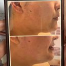 대구산격동우체국 | [대구북구 산격동] 1:1 맞춤형 피부윤곽관리 셀린비 셀리브리티 관리 후기｜셀린비 인증샵 “그리다네일”