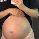 이화산부인과의원 | 조기에 배뭉침, 진통이 있었던 임산부의 37W 미즈 산부인과 정기진료